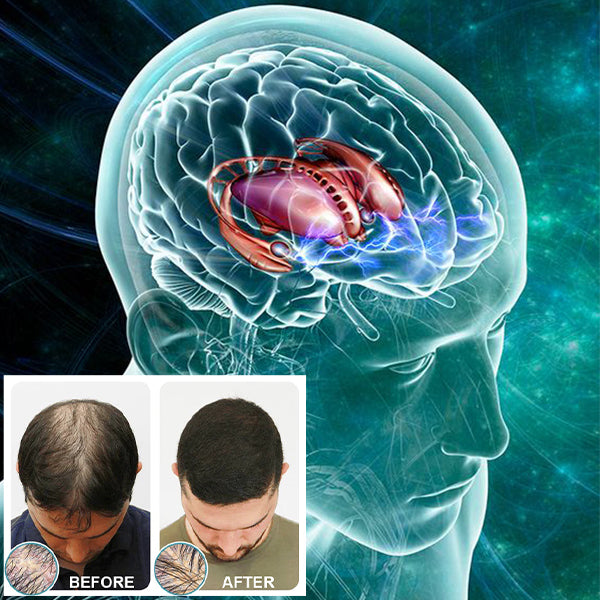 Nurbini™ EMS Hair Reborn Scalp Acupoint Massager