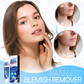 WART-LESS Immediate Blemish Removal Cream